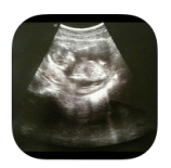 Screen Shot 2015-05-16 at 9.33.58 AM